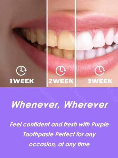 Flavored Whitening Toothpaste